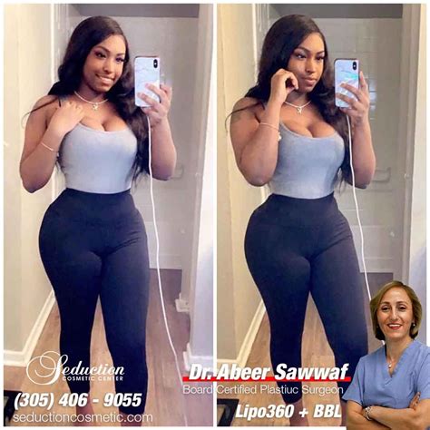 seduction cosmetic center photos|Before and After Gallery ️ Seduction Cosmetic Center